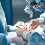 Surgical nerve damage compensation - manchin injury law